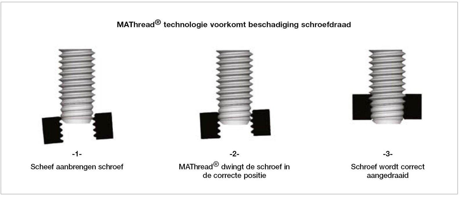 Technologie voorkomt beschadiging schroefdraad